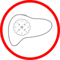Alanine Aminotransferase (ALT) Test