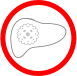ALT (alanine aminotransferase) Test